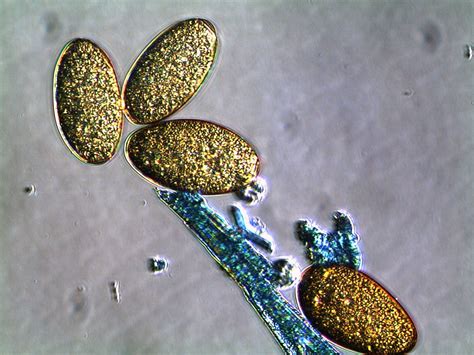 Fasciola Hepatica