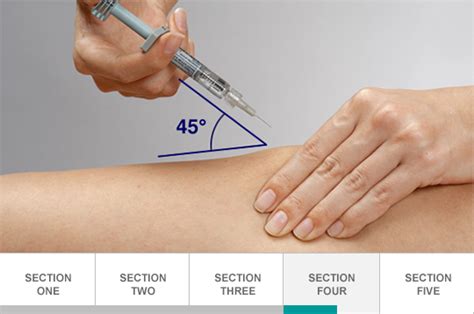 Dosing, Administration, and Injection Demo Videos | Enbrel® (etanercept)