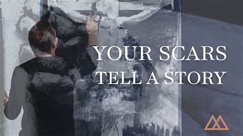 Your Scars Tell A Story Youtube