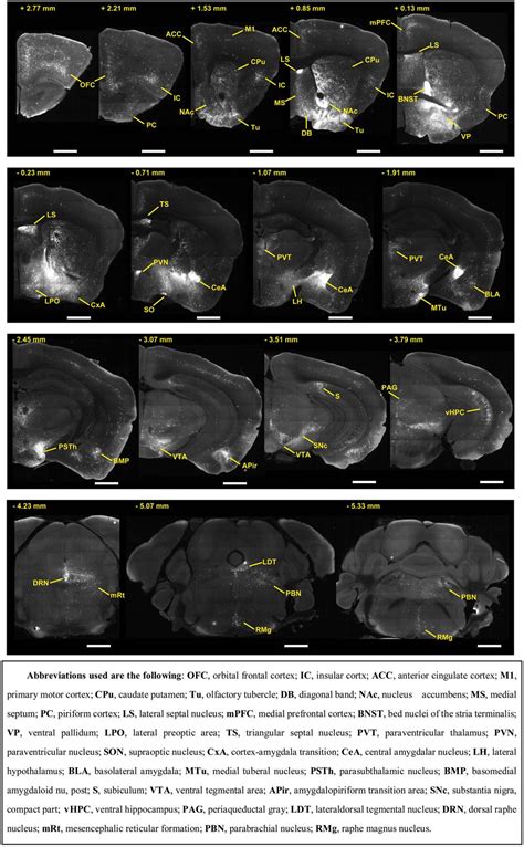 Frontiers Whole Brain Monosynaptic Afferent Inputs To Basal Forebrain