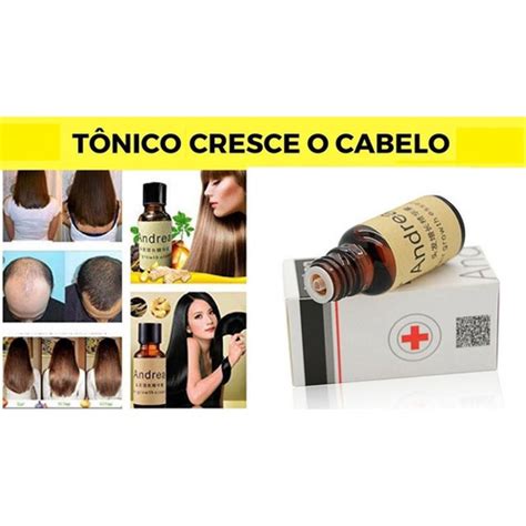 Oleo Para Crescer Cabelo Tratamento Calvice Tem Cura em Promoção