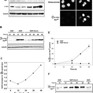 N Terminal Phosphorylation Of C Jun Is Induced During Neuronal