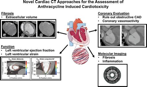 Frontiers Novel Cardiac Computed Tomography Methods For The