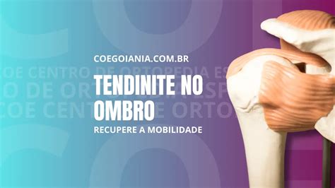 Fisioterapia Para Tendinite No Ombro Recupere A Mobilidade