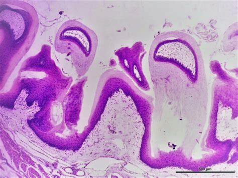 Mucosa Lingual Histología Y Embriología