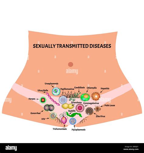 Sexually Transmitted Infections Pictures