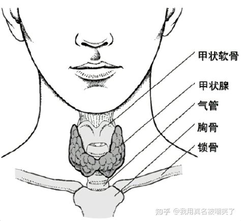 关于甲状腺结节的一切 知乎