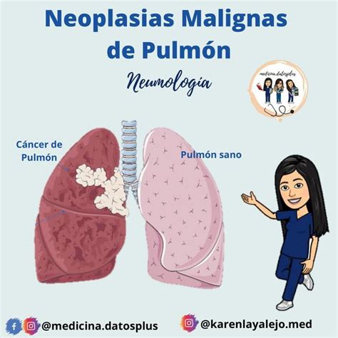 Neoplasias Malignas De Pulmon Apuntes De Medicina Res Menes De