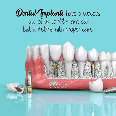 Dental Implants A Good Option For Missing Teeth Acaciadentalcentre