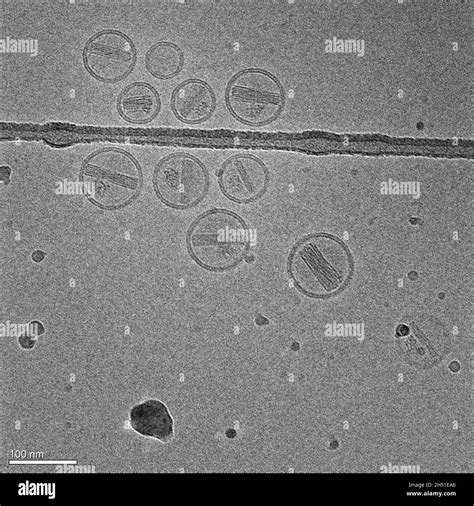 Microgr Fica Con Nanopart Culas Hechas De L Pidos Que Contienen Un