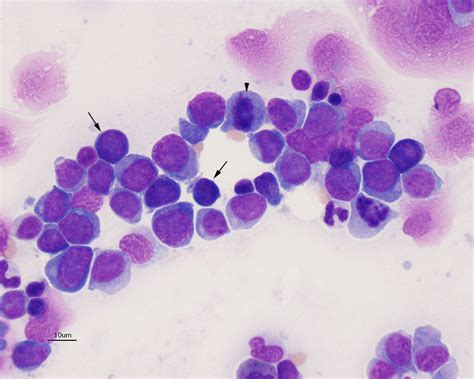 Blasts In A Bone Marrow Aspirate From A Cat With Aml Eclinpath