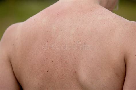 Sirva La Piel Seca O La Pigmentaci N En Las Piernas Con La Rodilla