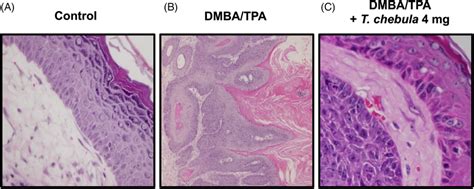 The Effect Of T Chebula Extract Mg On Dmba Tpa Induced Epidermal