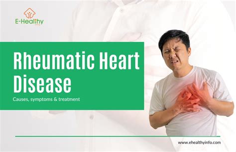 Rheumatic Heart Disease Risk Factors Symptoms Diagnosis And Treatment