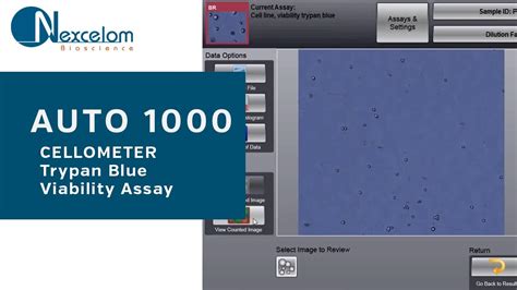 Performing The Trypan Blue Viability Assay Using Automated Cell Counting Youtube