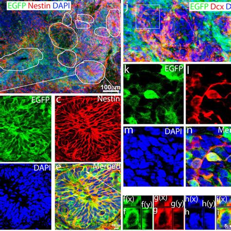 Reprogrammed Cell Derived Immature Neurons Developed Into Mature