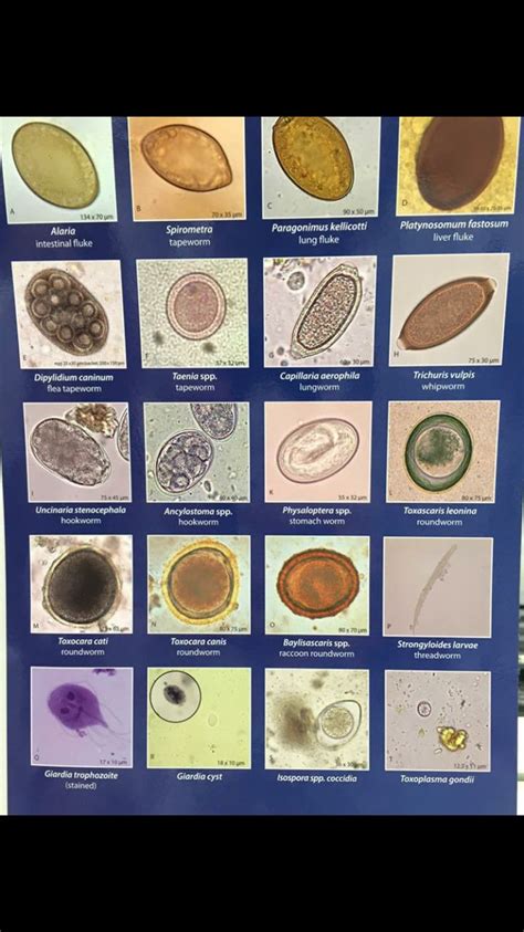 Ova And Cyst Vet Tech School Medical Laboratory Science Medical