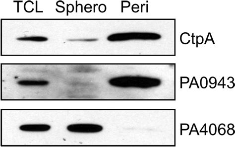 The Pseudomonas Aeruginosa Periplasmic Protease Ctpa Can Affect Systems