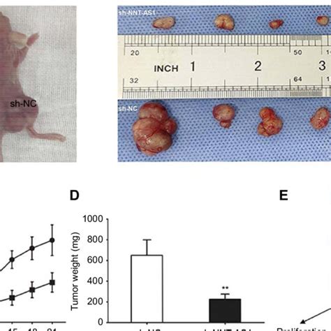 Nnt As Knockdown Suppressed Tumor Growth In Vivo Notes A Tumors