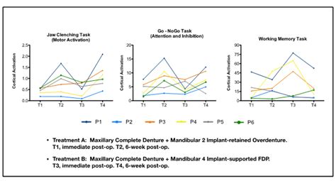 implant-retained overdenture vs fixed prosthesis - ITI Blog