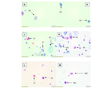 Papanicolaou Stained Preparations With ×100 Objective And ×10 Optics Download Scientific