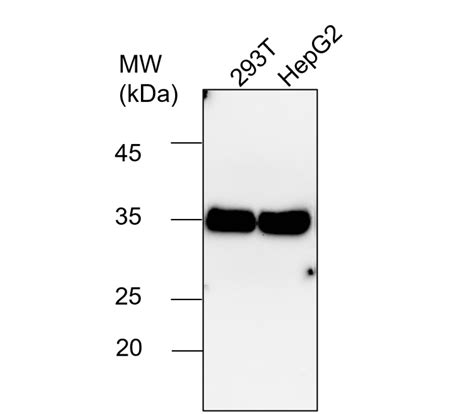 Inflammasome Antibody Panel Irap Ireal Biotechnology Inc