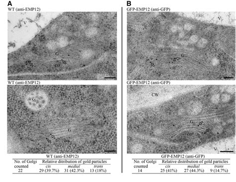 Figure From The Golgi Localized Arabidopsis Endomembrane Protein