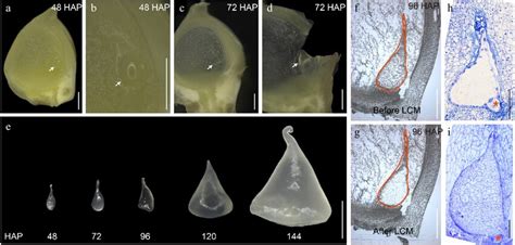 Isolation Of Early Endosperms From 48 To 144 HAP By Free Hand And LCM