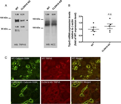 Phosphorylated Claudin 16 Interacts With Trpv5 And Regulates