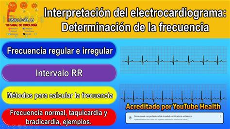 Electrocardiograma interpretación Electrocardiograma Determinación