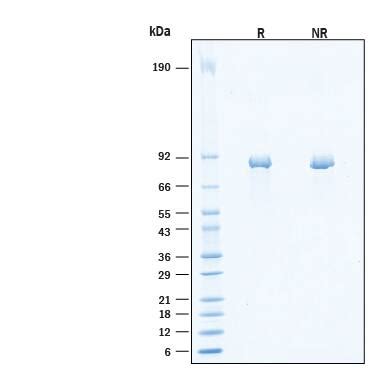 Recombinant Human Periostin Osf C A His Tag Protein Cf F