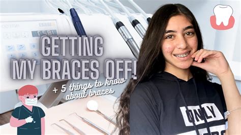 Finally Getting My Braces Off After 3 Years 5 Things You Should Know Before Getting Braces