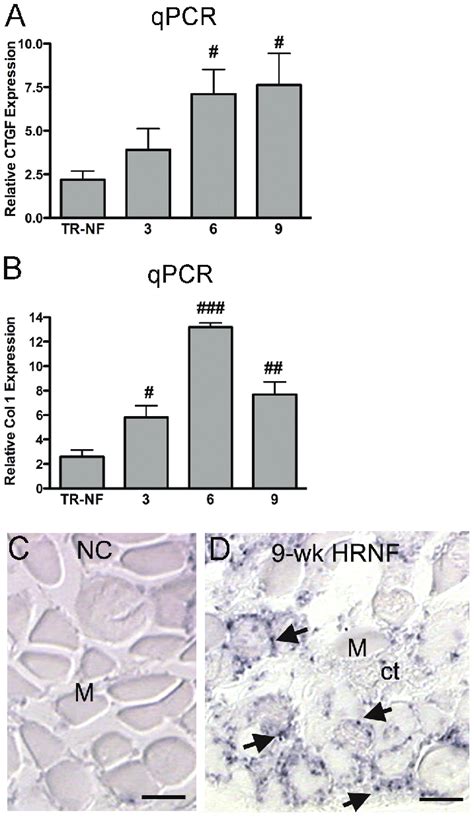 Examination Of Expression Levels Of Connective Tissue Growth Factor