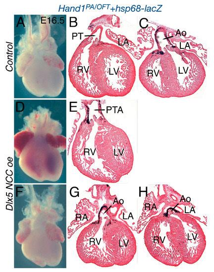 Mis Expression Of A Cranial Neural Crest Cell Specific Gene Program In