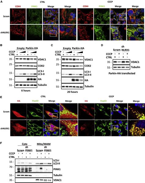 Mitochondrial Protein Import Stress Regulates The Lc3 Lipidation Step