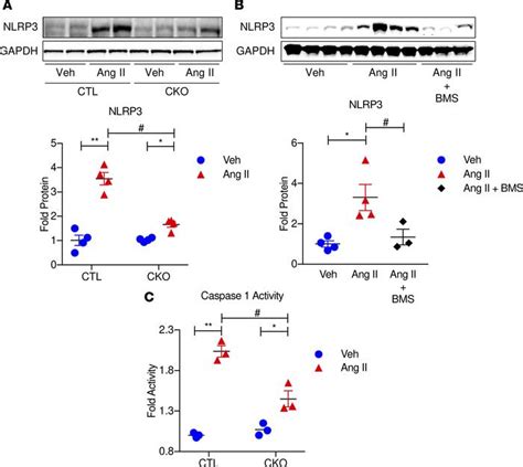 Jci Insight Camkiiδ Mediated Inflammatory Gene Expression And Inflammasome Activation In