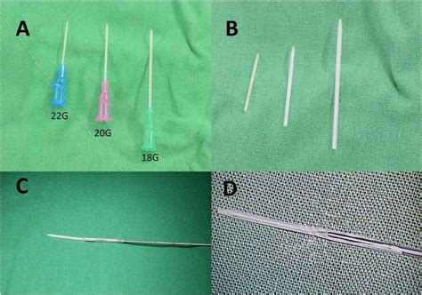 Preparation Of The Modified Angiocatheter And Preinstallation Of The