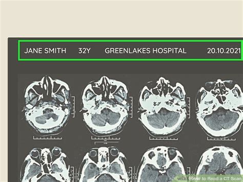 How To Read A CT Scan 8 Steps With Pictures WikiHow