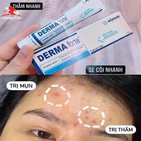 Review Derma Forte Kem Trị Mụn Derma Forte Có Thật Sự Hiệu Quả