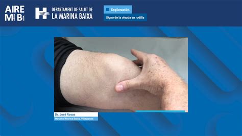 Signo De La Oleada En Rodilla Aire Mb