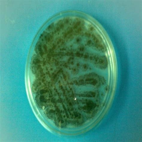 Aspergillus Niger Purified Figure 3 Pure Culture Of Aspergillus Niger Download Scientific