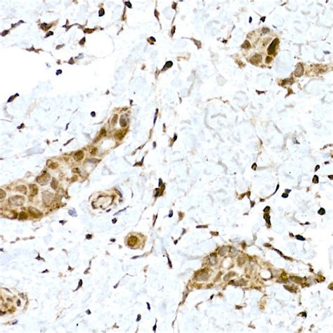 High Affinity And Specificity NRF2 Polyclonal Antibody E AB 68254 At