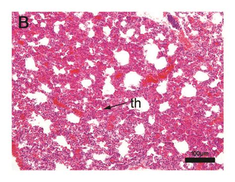 Histopathological Analysis Of Mice Lung Tissue Nontreated Balbc Mice