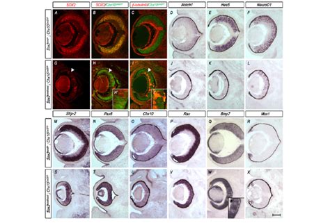 Mosaic Ablation Of Sox In Neural Progenitor Cells Using Chx Cregfp