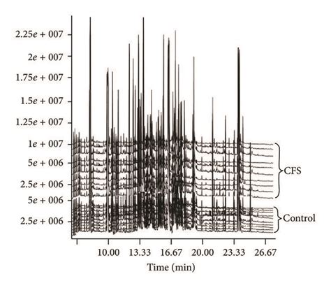 Total Ion Chromatograms Of The Urine Samples Obtained From The Cfs And Download Scientific