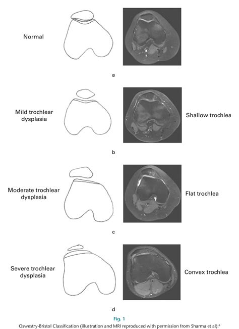 Figure From A Comparative Analysis Of Interobserver Reliability And