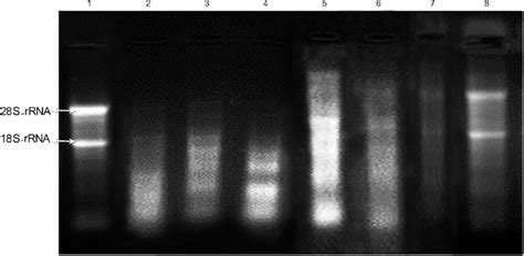 Pdf Optimization Of Rna Extraction From Rat Pancreatic Off