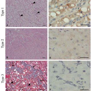 Microscopic Morphology Of The Endometrium Using Hematoxylin And Eosin