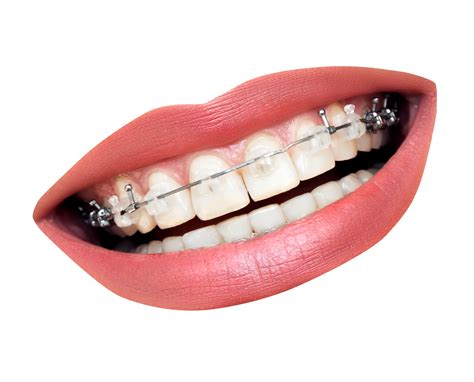 Teeth PNG, Teeth Transparent Background - FreeIconsPNG