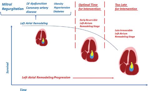 Mitral Regurgitation Edgetoedge Valve Repair And The Left Atrium